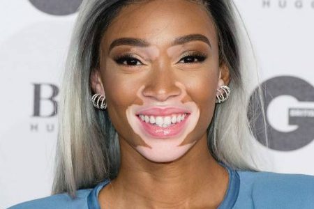 Winnie Harlow