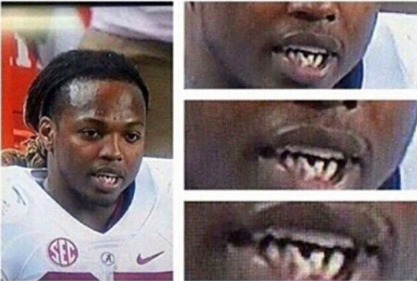 Derrick Henry's teeth picture of his past
