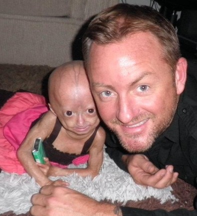 Adalia Rose with his father