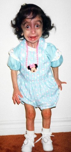 Lizzie Velasquez