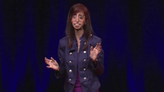 Lizzie Velasquez