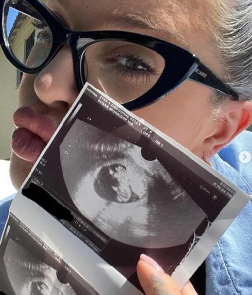 Kelly Osbourne with the photo of Ultrasound